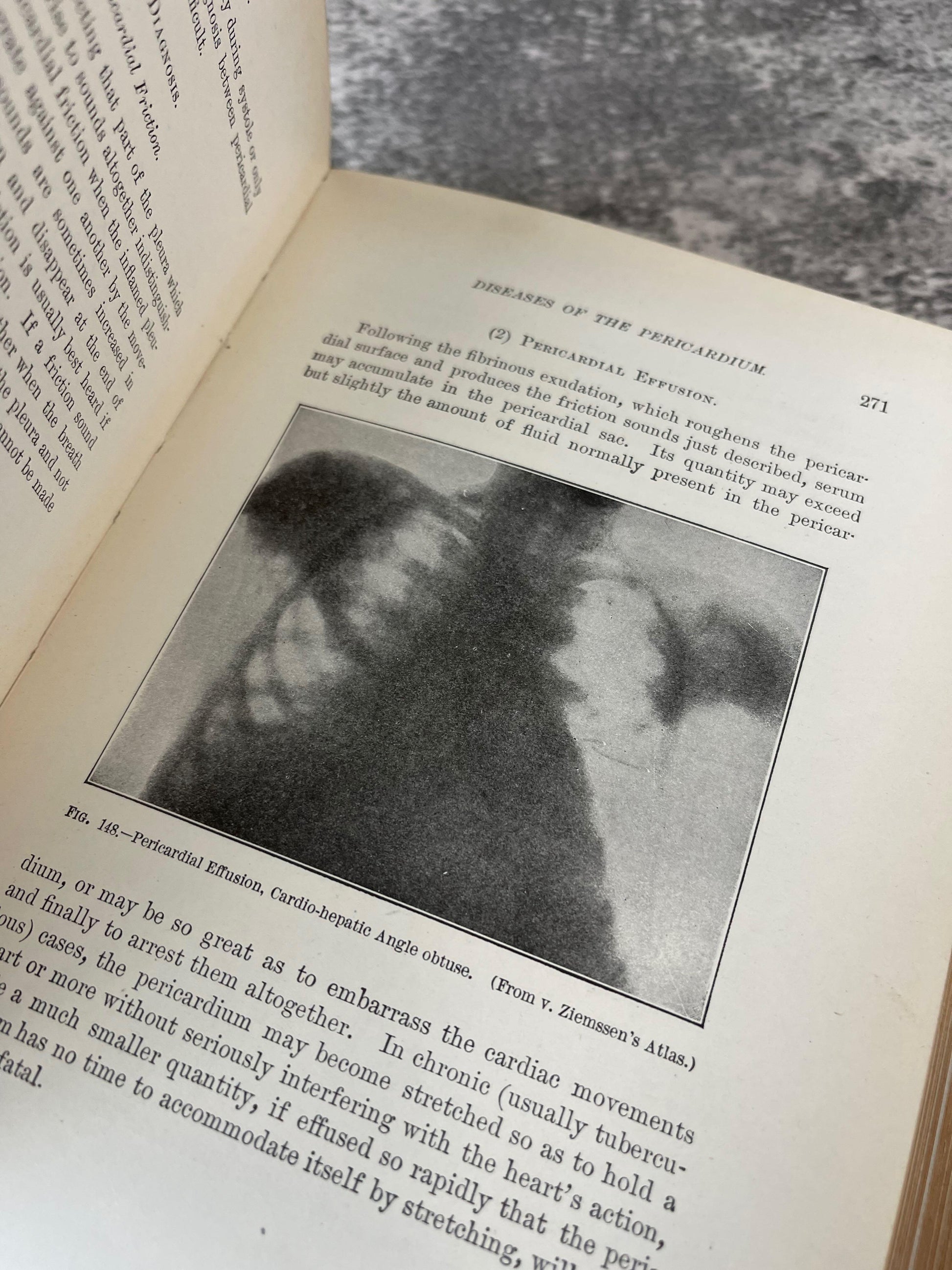 Physical Diagnosis / Ex-Library, Fourth Edition / 1910 - Precious Cache