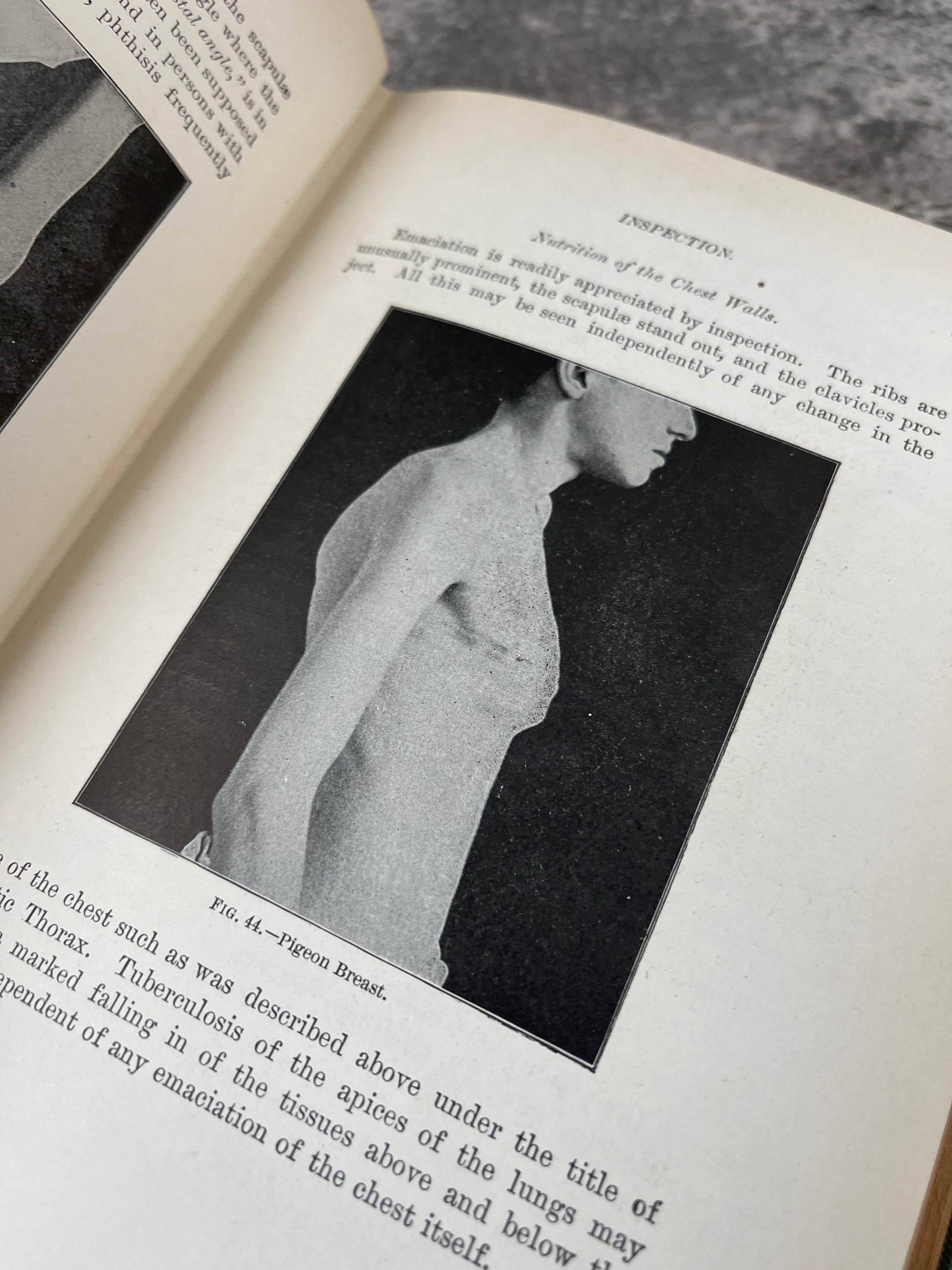 Physical Diagnosis / Ex-Library, Fourth Edition / 1910 - Precious Cache