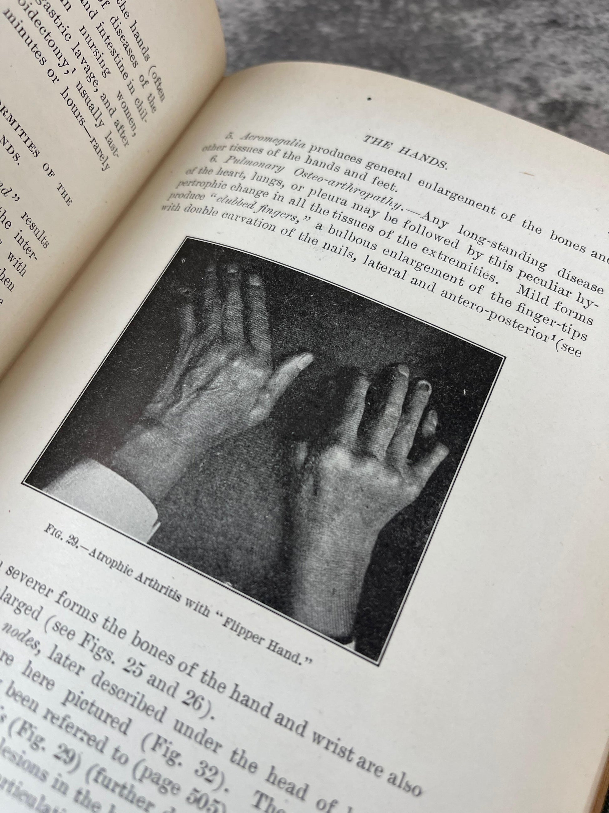 Physical Diagnosis / Ex-Library, Fourth Edition / 1910 - Precious Cache
